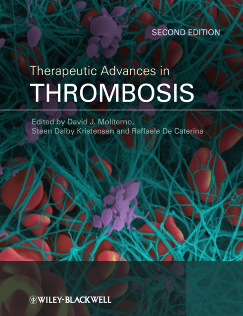 Therapeutic Advances in Thrombosis, PDF eBook