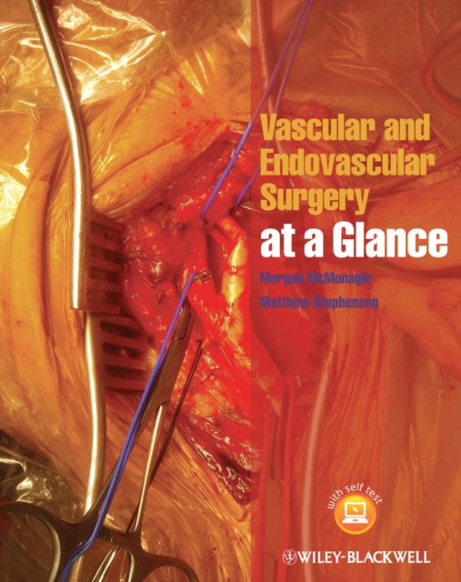 Vascular and Endovascular Surgery at a Glance, Paperback / softback Book