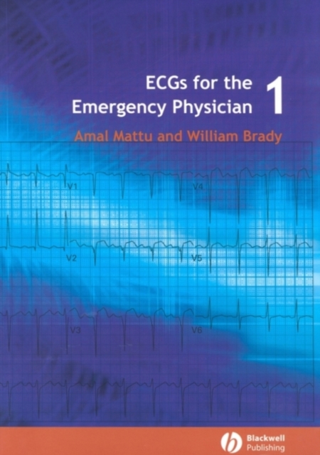 ECGs for the Emergency Physician 1, EPUB eBook