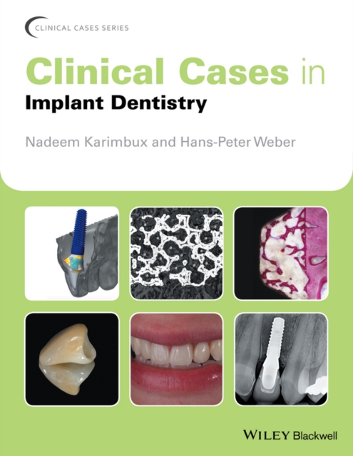 Clinical Cases in Implant Dentistry, Paperback / softback Book