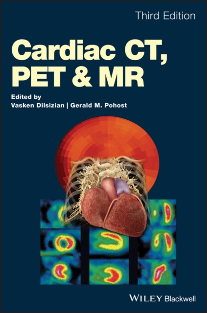 Cardiac CT, PET and MR, PDF eBook
