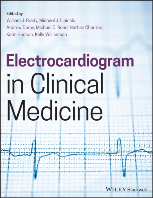 Electrocardiogram in Clinical Medicine, Paperback / softback Book