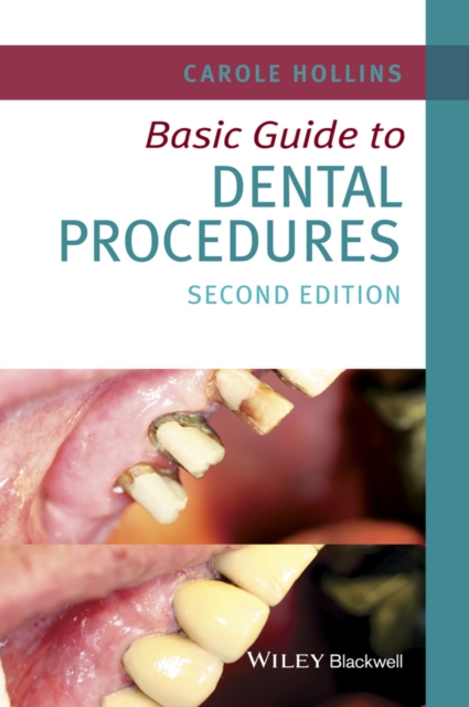 Basic Guide to Dental Procedures, Paperback / softback Book