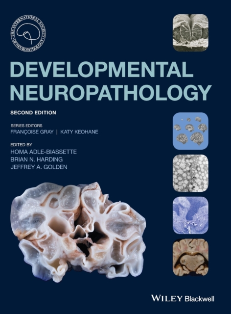 Developmental Neuropathology, Multiple-component retail product Book