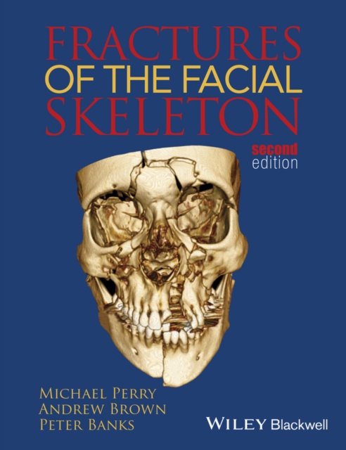 Fractures of the Facial Skeleton, PDF eBook