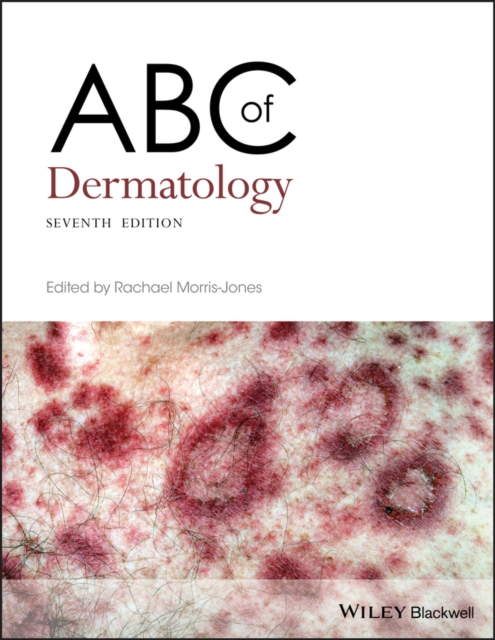 ABC of Dermatology, Paperback / softback Book
