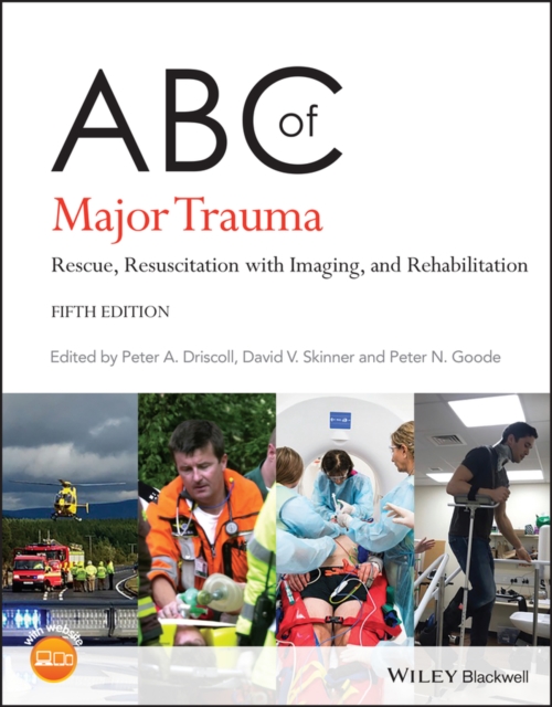 ABC of Major Trauma : Rescue, Resuscitation with Imaging, and Rehabilitation, Paperback / softback Book