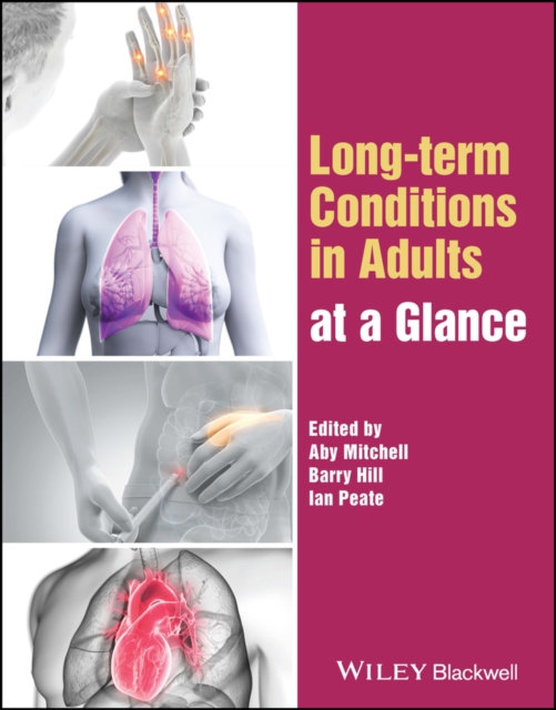 Long-term Conditions in Adults at a Glance, PDF eBook