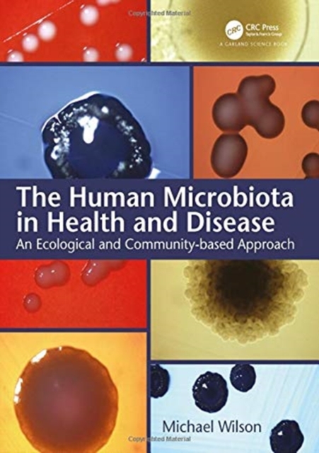 The Human Microbiota in Health and Disease : An Ecological and Community-based Approach, Hardback Book