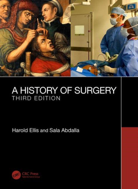 A History of Surgery : Third Edition, Paperback / softback Book