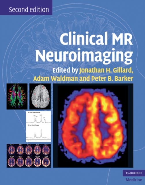 Clinical MR Neuroimaging : Physiological and Functional Techniques, EPUB eBook