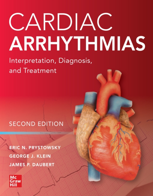 Cardiac Arrhythmias: Interpretation, Diagnosis and Treatment, Second Edition, EPUB eBook