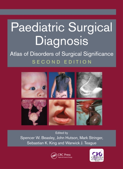 Paediatric Surgical Diagnosis : Atlas of Disorders of Surgical Significance, Second Edition, PDF eBook