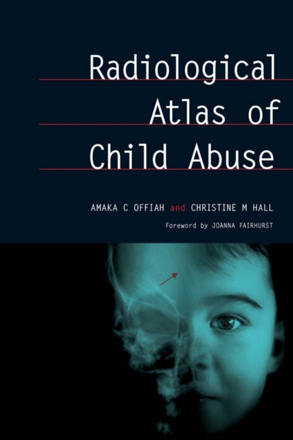Radiological Atlas of Child Abuse : A Complete Resource for MCQs, v. 1, EPUB eBook