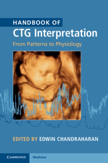 Handbook of CTG Interpretation : From Patterns to Physiology, EPUB eBook