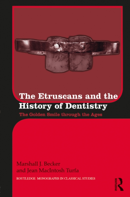 The Etruscans and the History of Dentistry : The Golden Smile through the Ages, EPUB eBook