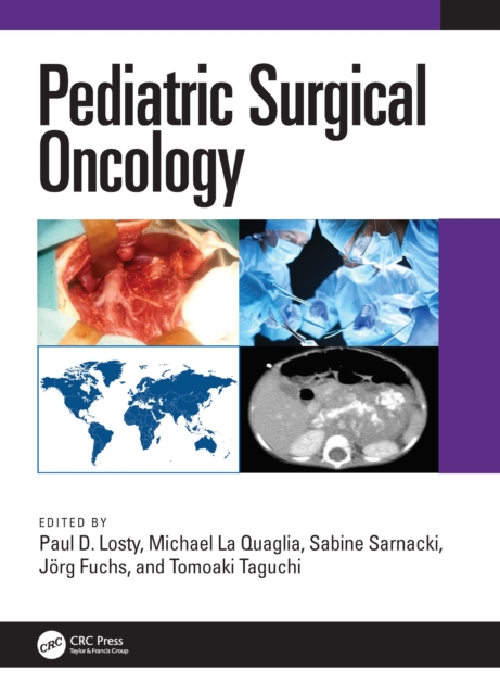 Pediatric Surgical Oncology, PDF eBook
