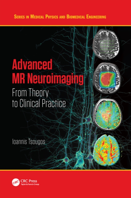 Advanced MR Neuroimaging : From Theory to Clinical Practice, PDF eBook