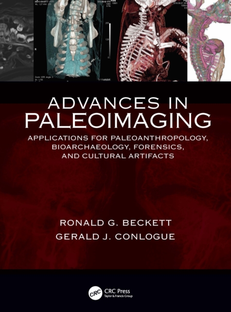 Advances in Paleoimaging : Applications for Paleoanthropology, Bioarchaeology, Forensics, and Cultural Artifacts, EPUB eBook