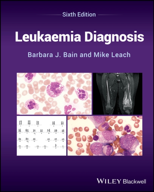 Leukaemia Diagnosis, EPUB eBook
