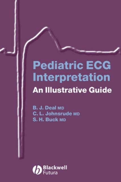Pediatric ECG Interpretation : An Illustrative Guide, Spiral bound Book