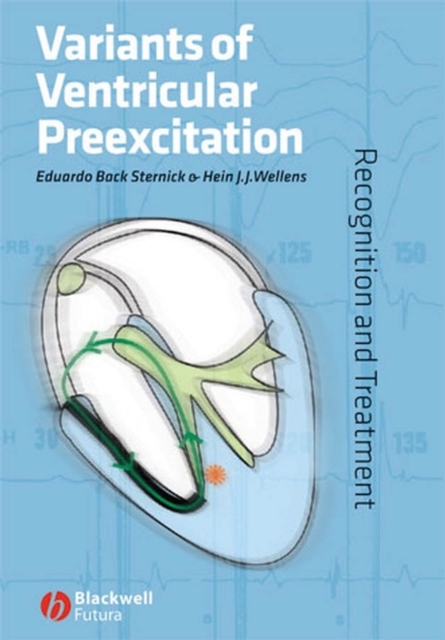 Variants of Ventricular Preexcitation : Recognition and Treatment, Hardback Book