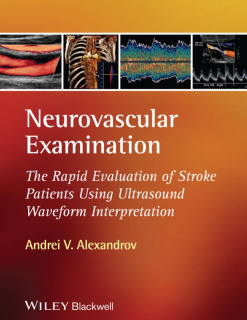 Neurovascular Examination : The Rapid Evaluation of Stroke Patients Using Ultrasound Waveform Interpretation, Hardback Book