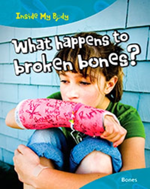What Happens to Broken Bones?, Paperback Book