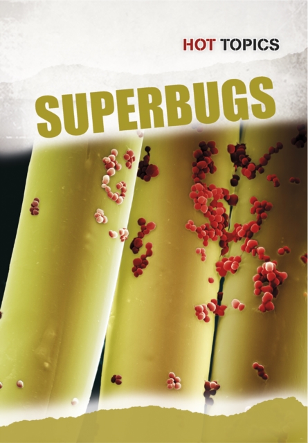 Superbugs, Hardback Book