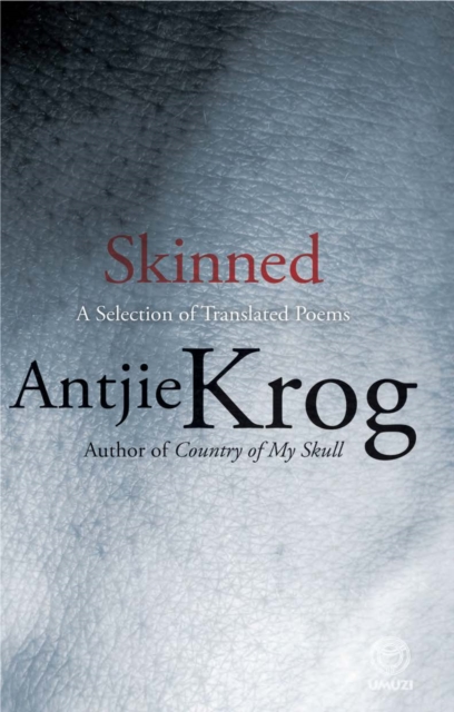 Skinned: Poems, EPUB eBook