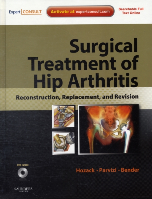 Surgical Treatment of Hip Arthritis: Reconstruction, Replacement, and Revision, Mixed media product Book