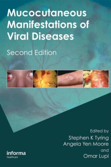 Mucocutaneous Manifestations of Viral Diseases : An Illustrated Guide to Diagnosis and Management, Hardback Book