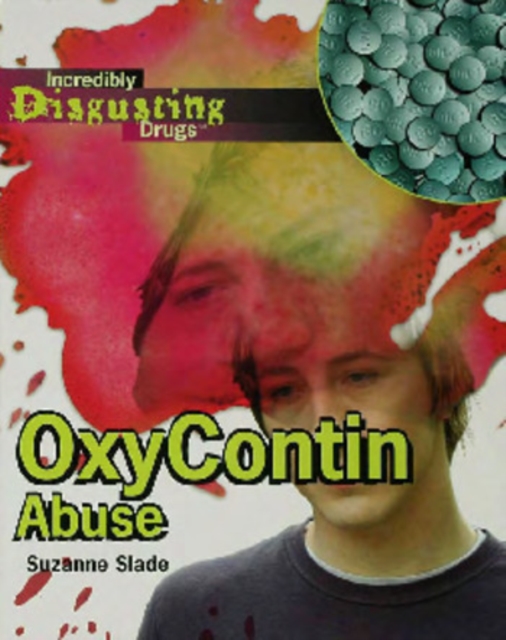 OxyContin Abuse, PDF eBook