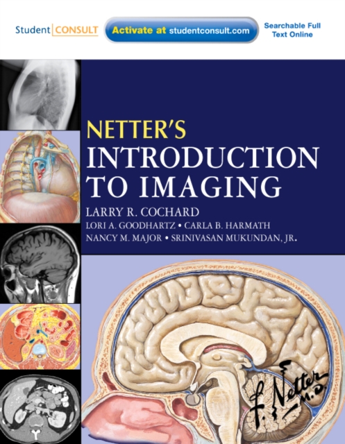 Netter's Introduction to Imaging : with Student Consult Access, Paperback / softback Book
