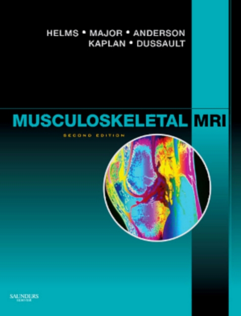 Musculoskeletal MRI E-Book, EPUB eBook