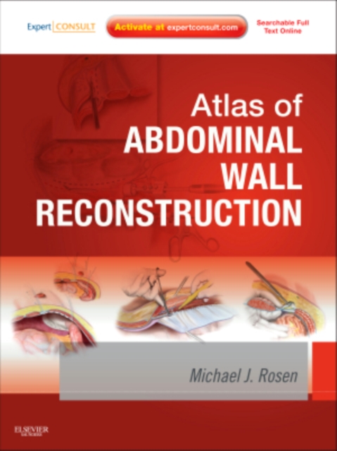 Atlas of Abdominal Wall Reconstruction, Mixed media product Book