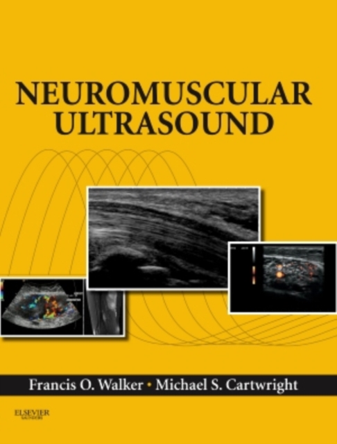 Neuromuscular Ultrasound E-Book : Expert Consult - Online and Print, EPUB eBook