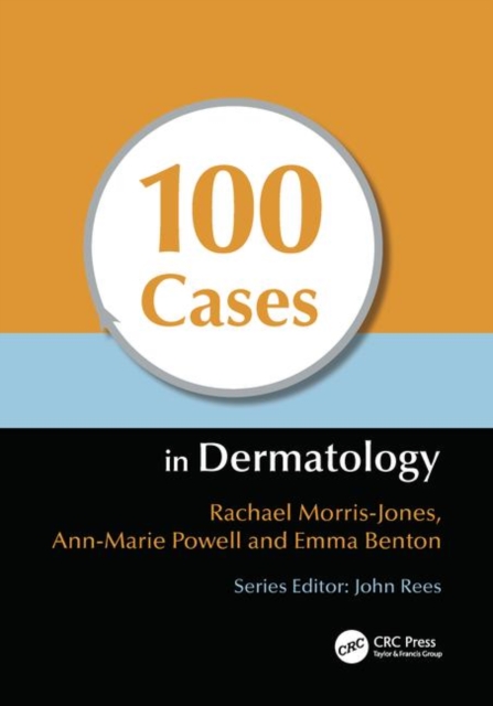 100 Cases in Dermatology, Paperback / softback Book