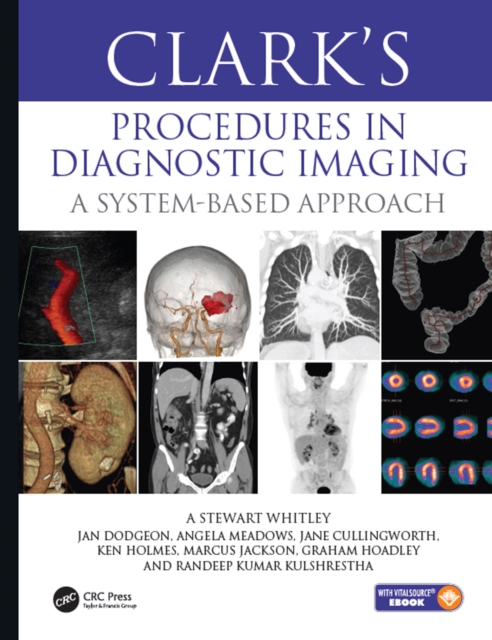 Clark’s Procedures in Diagnostic Imaging : A System-Based Approach, PDF eBook