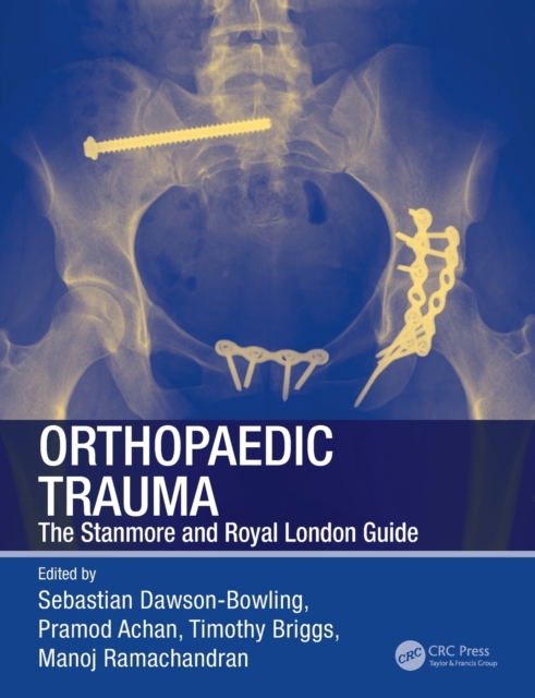 Orthopaedic Trauma : The Stanmore and Royal London Guide, Paperback / softback Book