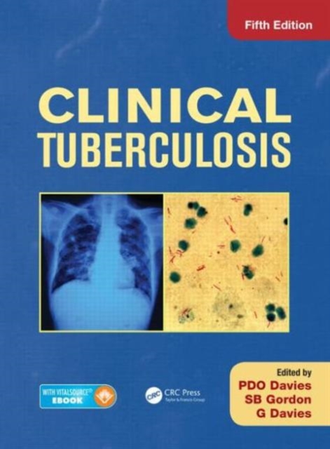 Clinical Tuberculosis, Hardback Book
