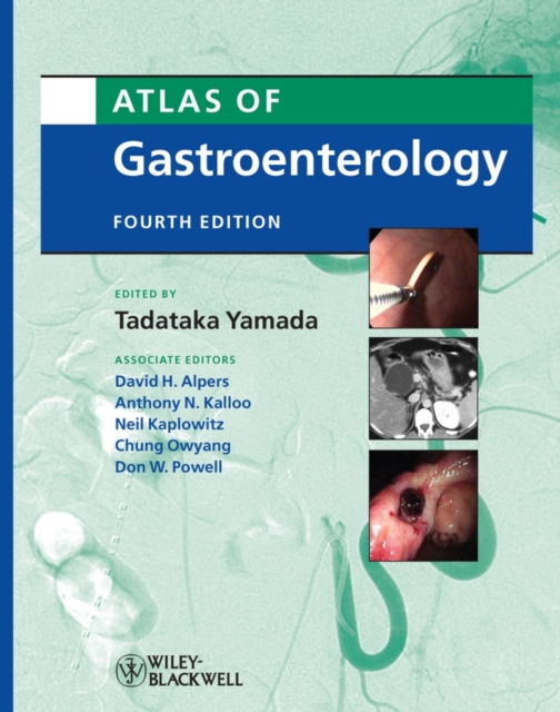 Atlas of Gastroenterology, PDF eBook