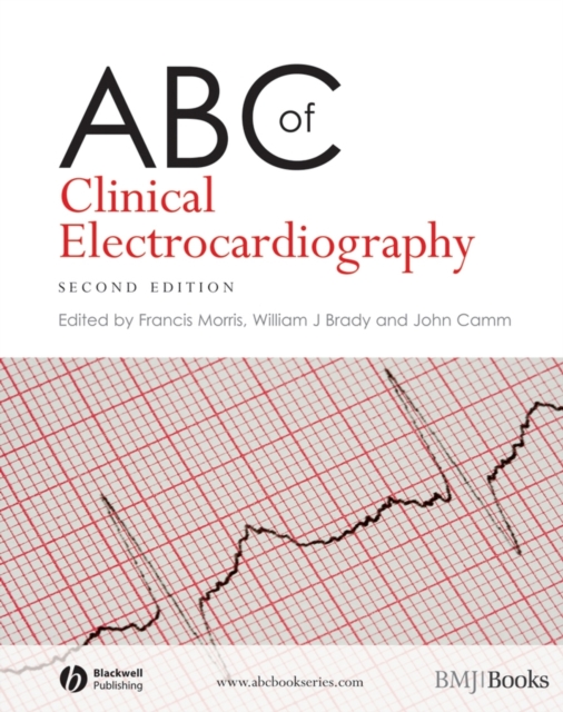 ABC of Clinical Electrocardiography, PDF eBook