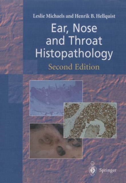 Ear, Nose and Throat Histopathology, Paperback / softback Book