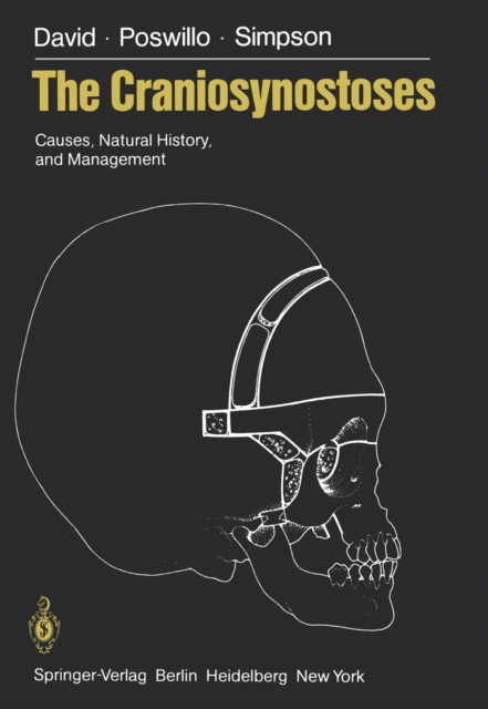 The Craniosynostoses : Causes, Natural History, and Management, PDF eBook