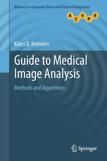 Guide to Medical Image Analysis : Methods and Algorithms, PDF eBook