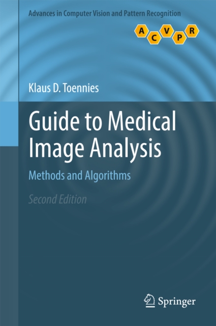 Guide to Medical Image Analysis : Methods and Algorithms, EPUB eBook