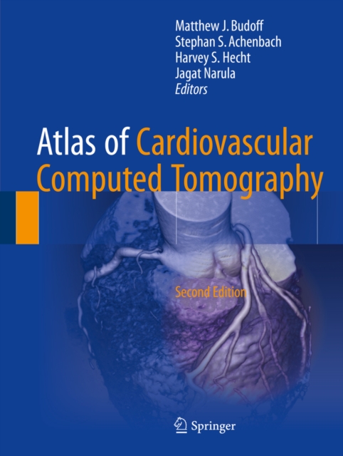 Atlas of Cardiovascular Computed Tomography, EPUB eBook