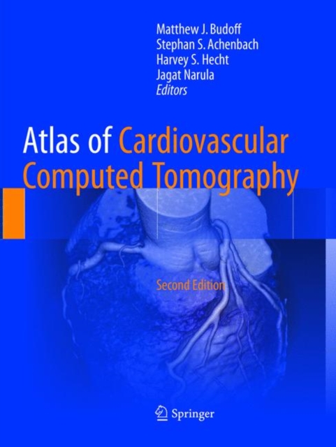 Atlas of Cardiovascular Computed Tomography, Paperback / softback Book