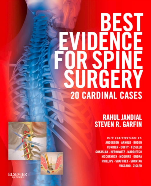 Best Evidence for Spine Surgery E-Book : 20 Cardinal Cases, EPUB eBook